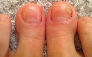 Anerer sprooch liesen